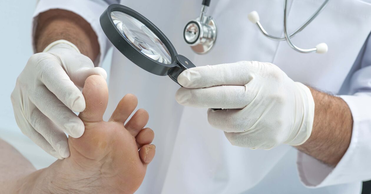 the doctor checks the feet for nail fungus