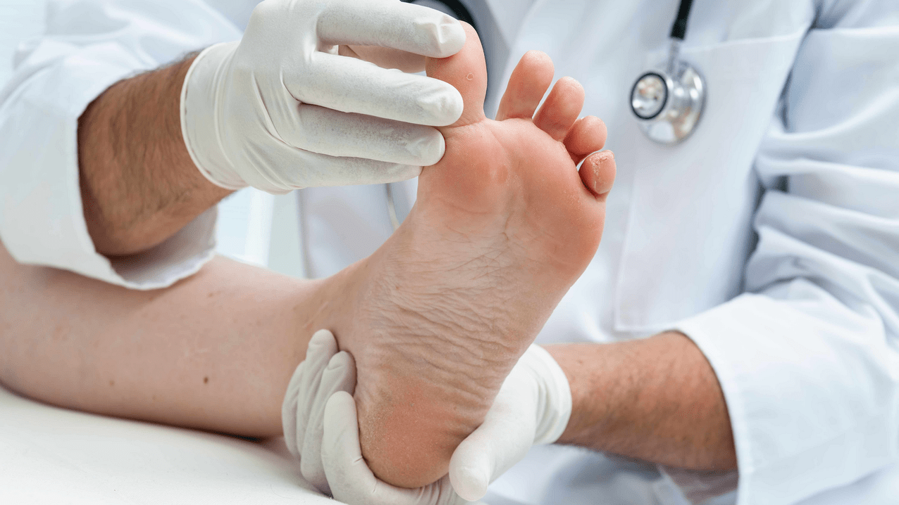 examination of the skin of the feet at a meeting with a specialist