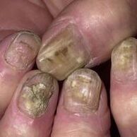 Used mushrooms