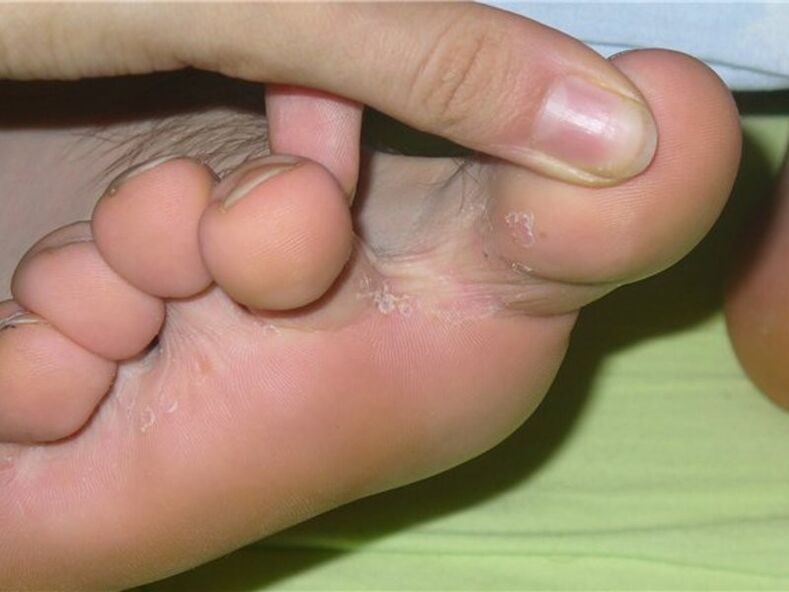 Mushrooms between fingers