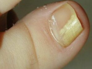 Nail trunk