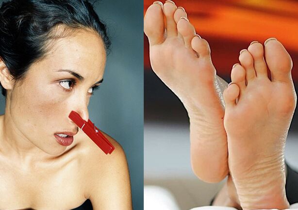 An unpleasant odor of legs