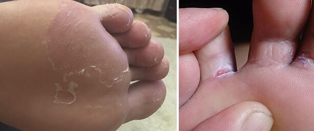 Finger-finger