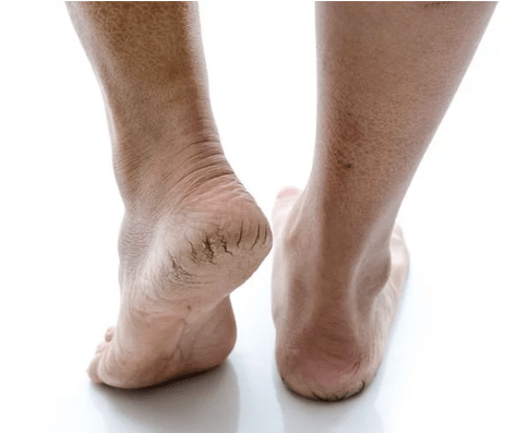 Mushrooms in the standing skin