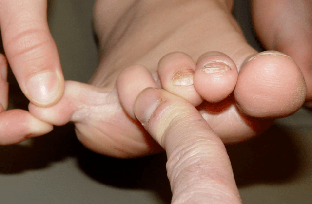 Mushrooms between fingers