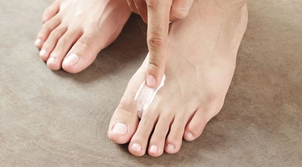 To apply cream from mushrooms between fingers