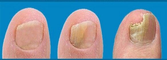 fungal development process